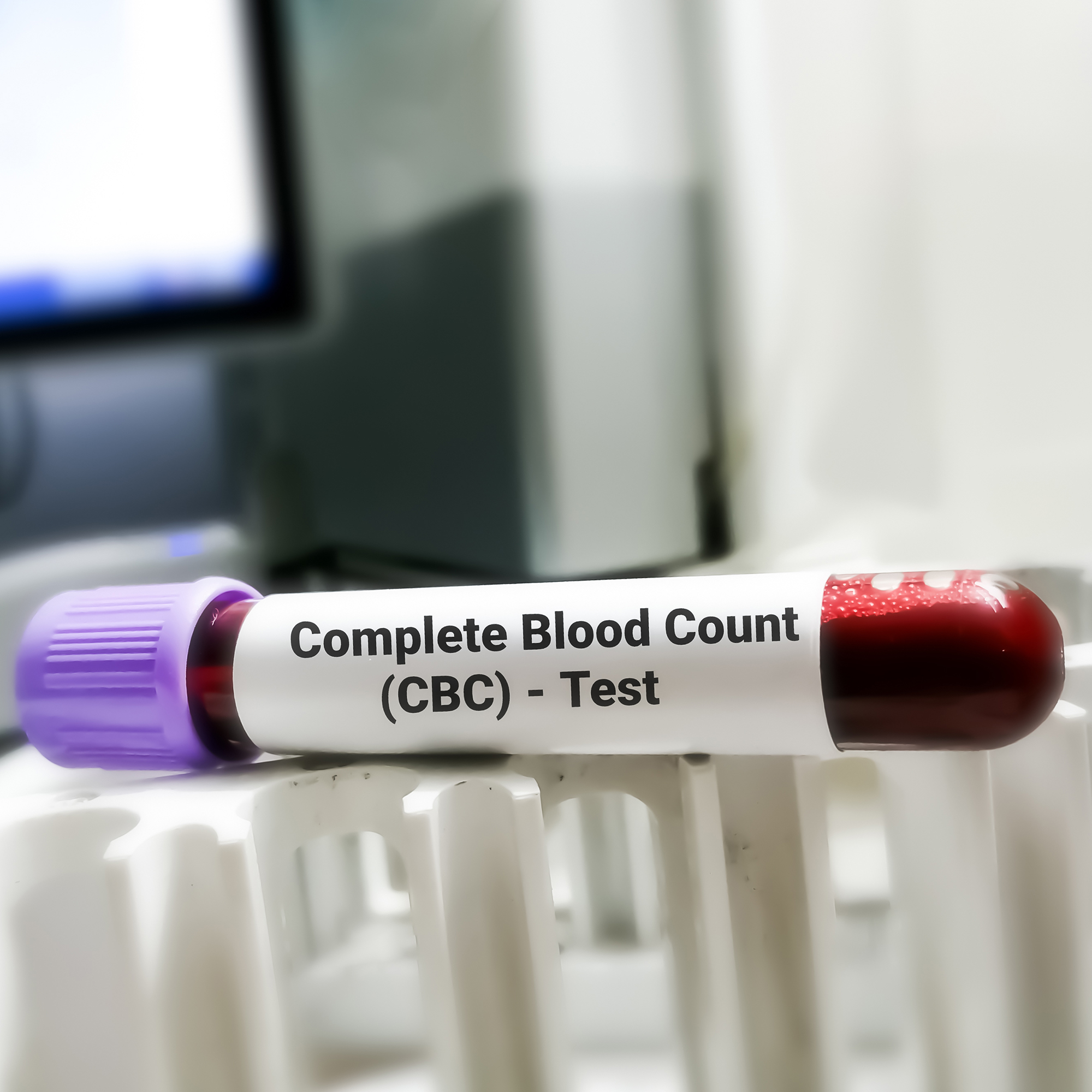Complete Blood Count (CBC) Test
