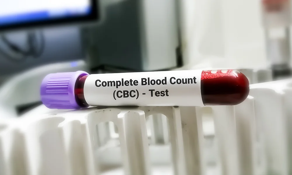 complete blood count